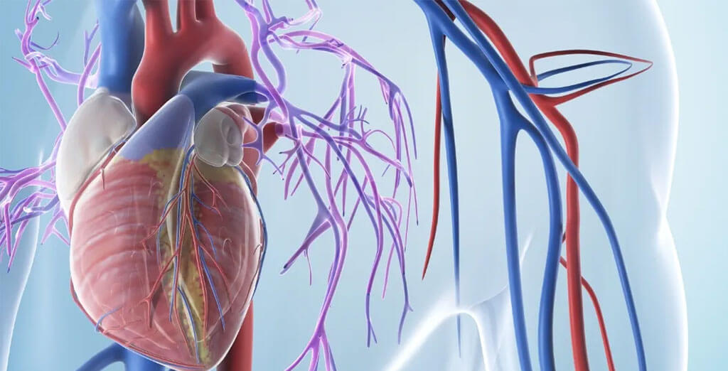 Coronary Artery Bypass Grafting (CABG) Surgery
