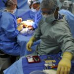 Understanding CABG Bypass Surgery: A Comprehensive Guide