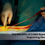 cabg bypass surgery