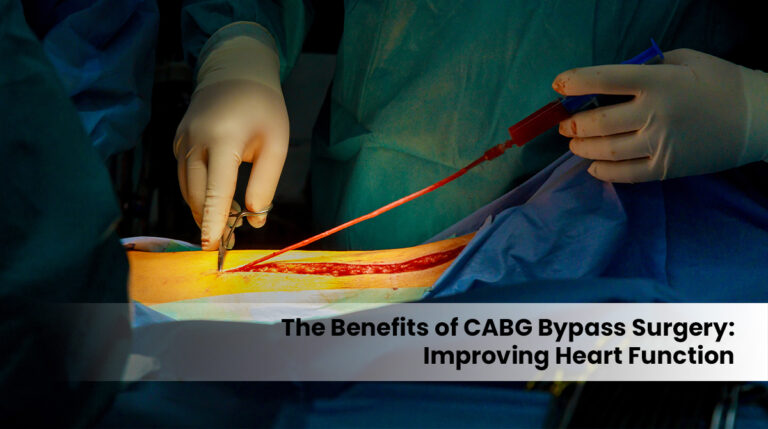 cabg bypass surgery