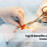 minimally invasive surgery