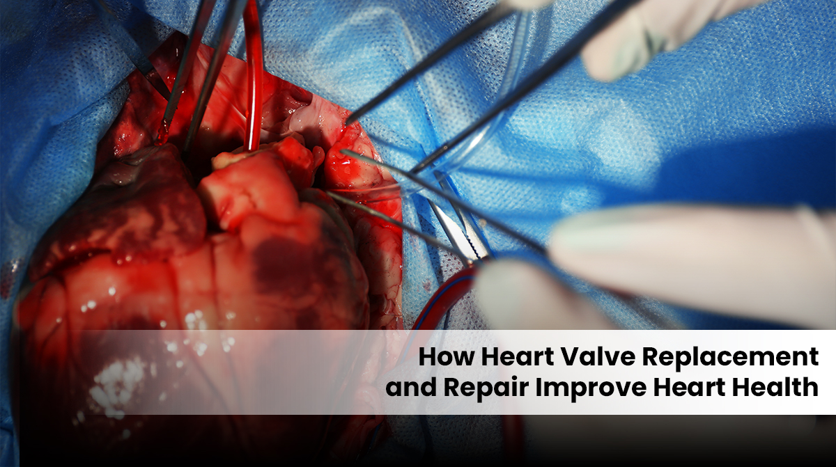 heart valve replacement surgery