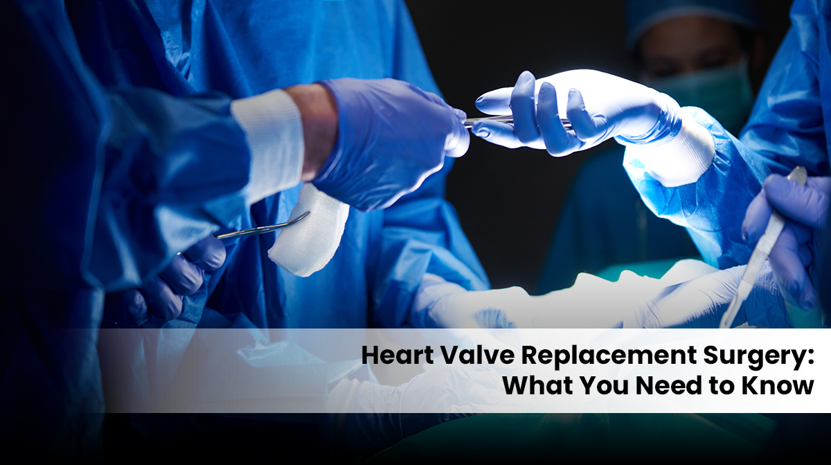 heart valve surgery in Gurgaon