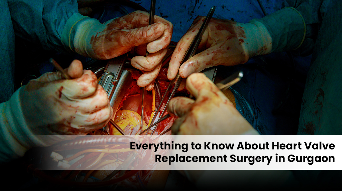 heart valve replacement surgery in Gurgaon