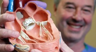 heart valve replacement surgery