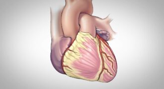 coronary artery bypass graft