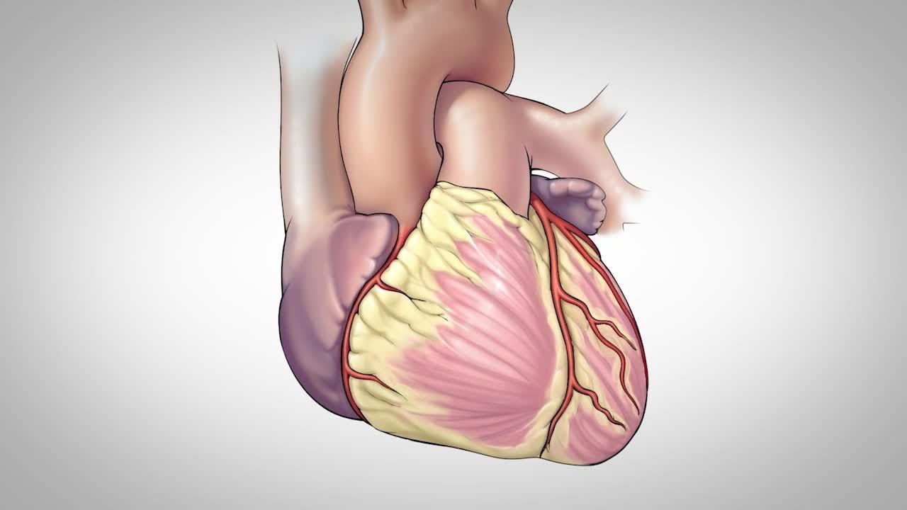 coronary artery bypass graft